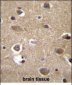 MRPL9 Antibody (N-term)